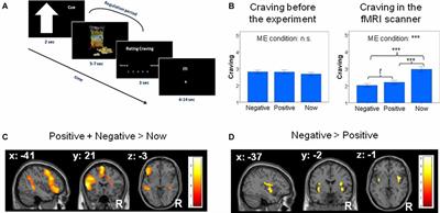 Regulating Craving by Anticipating Positive and Negative Outcomes: A Multivariate Pattern Analysis and Network Connectivity Approach